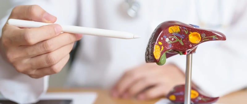 Liver model