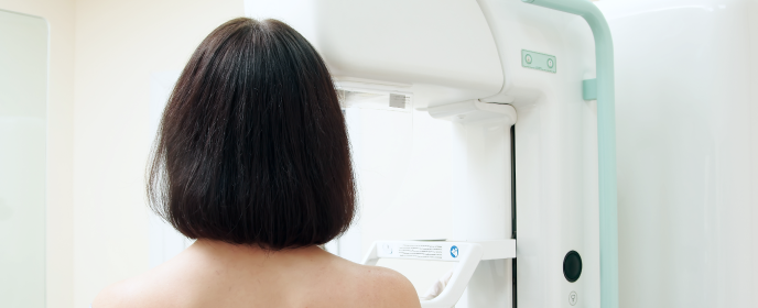 woman undergoing Digital Mammography