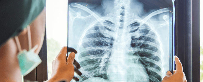 doctor examining xray